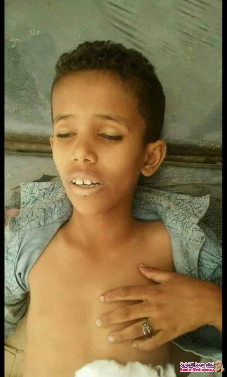 جريمة لمليشيات الحوثي ضد الطفولة في مقبنة 