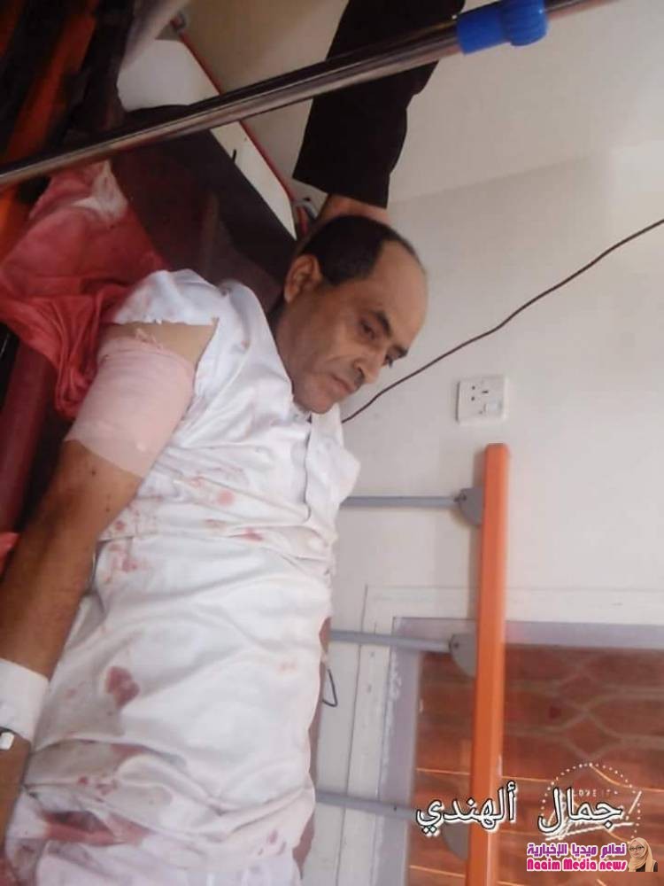 تعز ..استشهاد امرأة وطفل جراء استهداف مدفعي في 7 يوليو واصابة اخرون