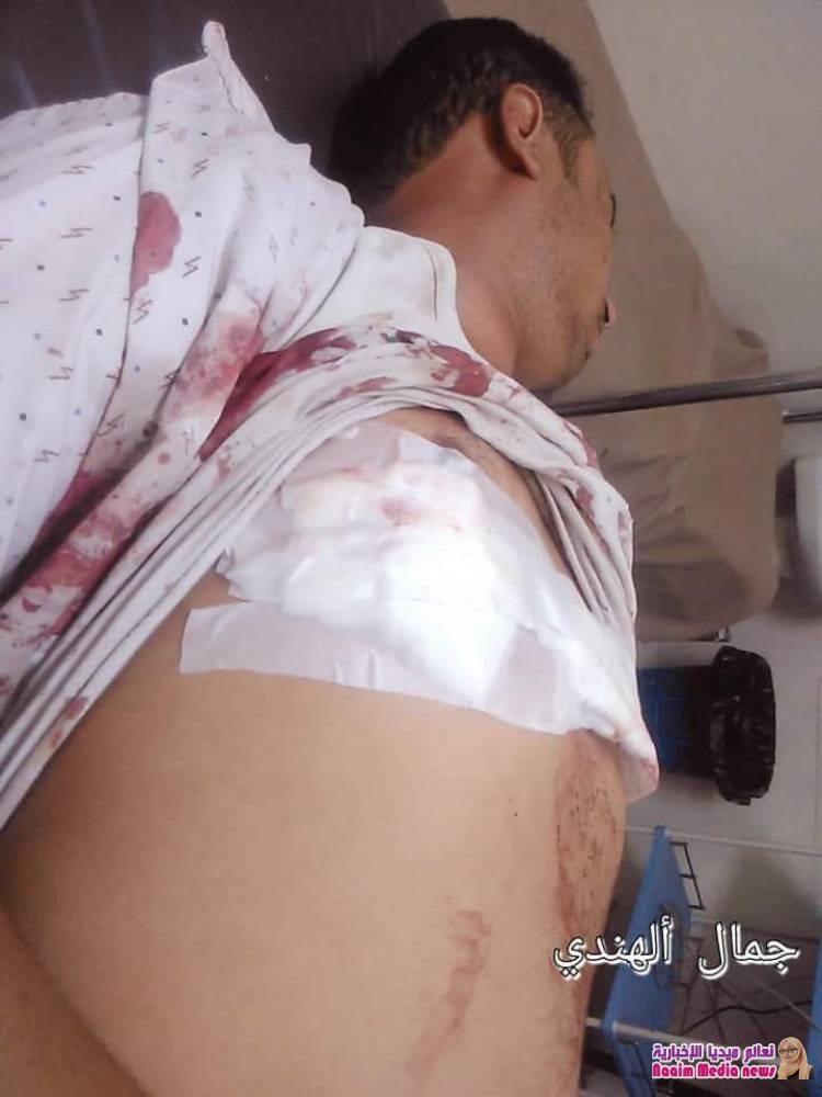 تعز ..استشهاد امرأة وطفل جراء استهداف مدفعي في 7 يوليو واصابة اخرون