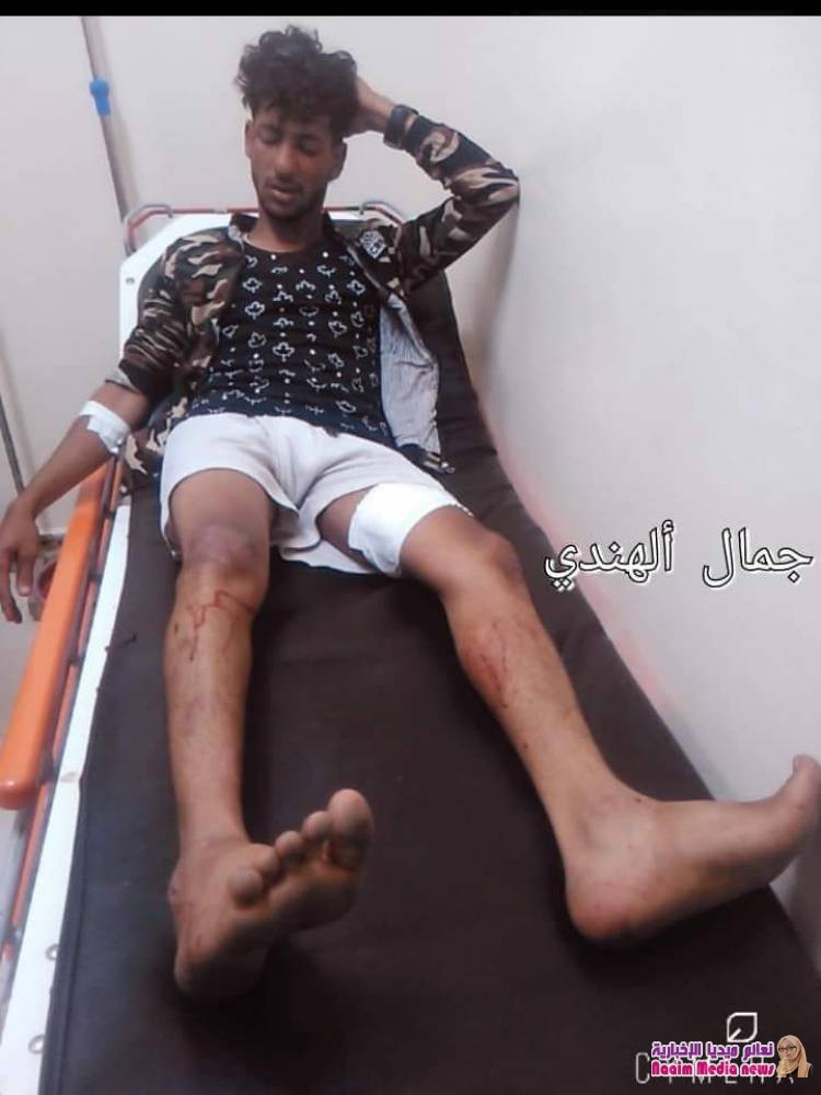 تعز ..استشهاد امرأة وطفل جراء استهداف مدفعي في 7 يوليو واصابة اخرون