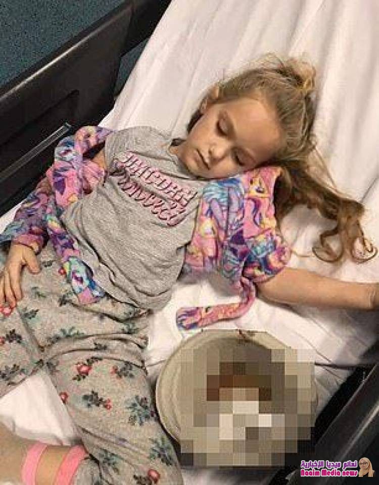 طفلة بريطانية تتقيأ جلطات دموية بسبب الإهمال الطبي