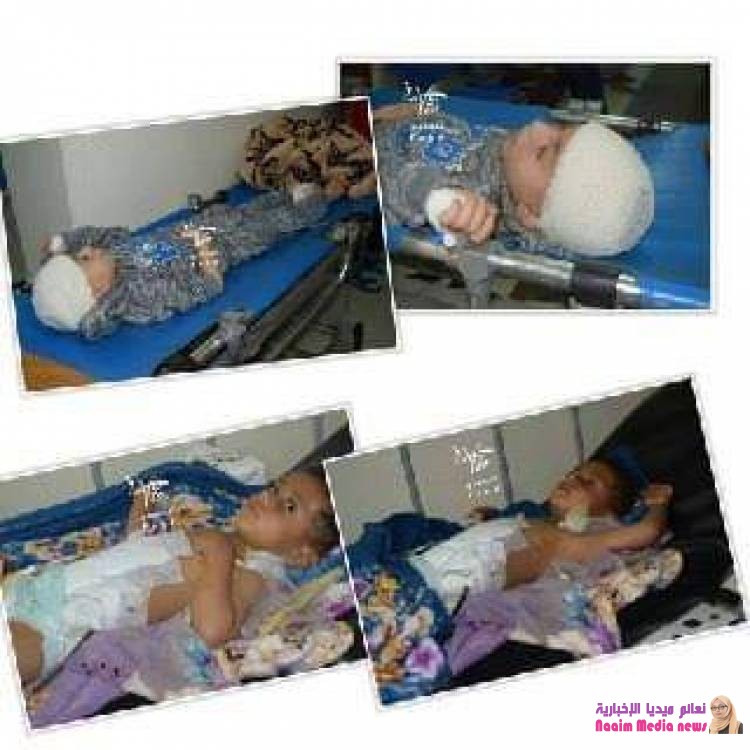 تعز : إصابة 3 أطفال جراء انفجار قذيفة ... 