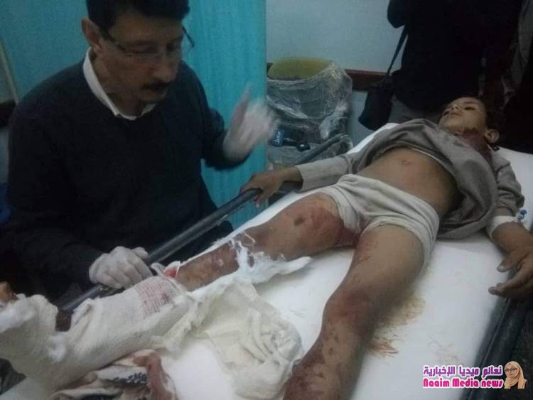 المليشيا_الحوثية_الايرانية تستهدف بصاروخ كاتيوشا أطلق من مواقعها في جبل هيلان مساء اليوم ، حي الروضة 