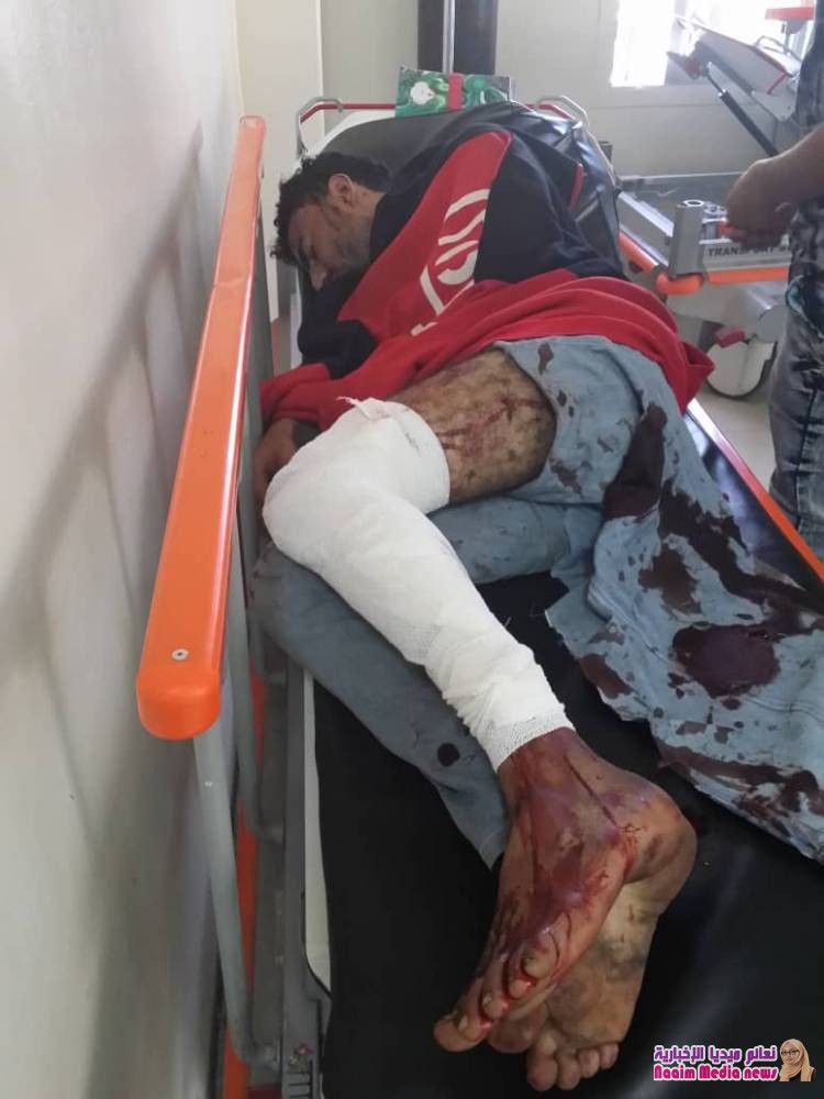 استشهاد امرأة وإصابة 13 مدنياً بقصف مليشيا الحوثي حي الشماسي بتعز