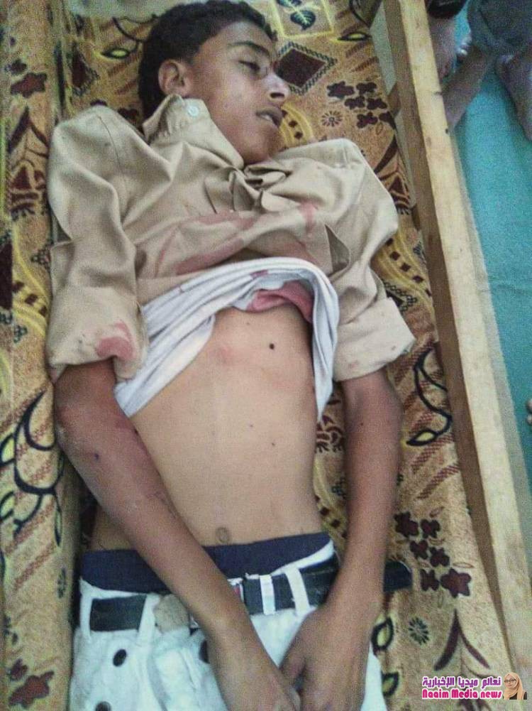 إستشهاد طفل بقصف لمليشيات الحوثي على مدرسة بالصلو  جنوب تعز 