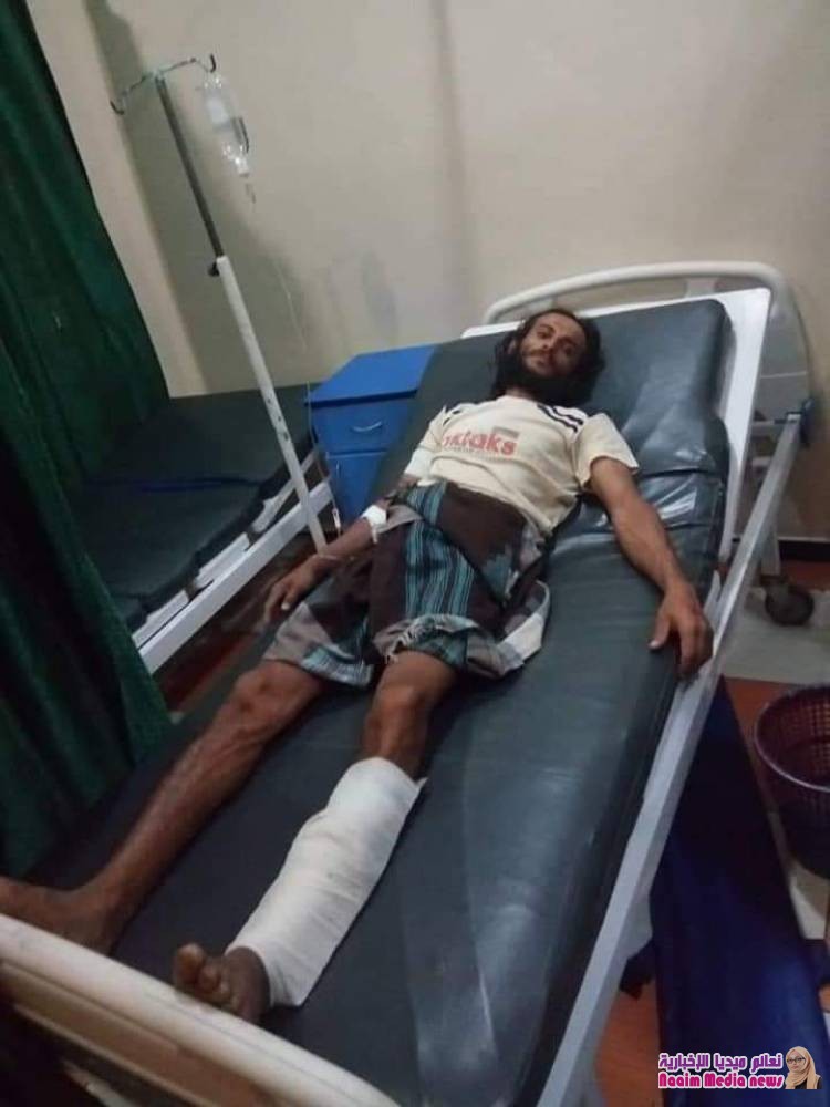 إصابة 3 عمال شمال غرب مدينة تعز بنيران مليشيا الحوثي 