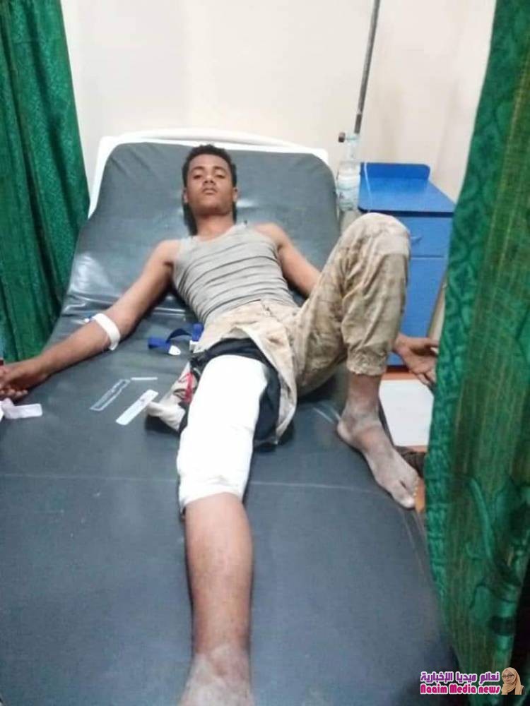 إصابة 3 عمال شمال غرب مدينة تعز بنيران مليشيا الحوثي 