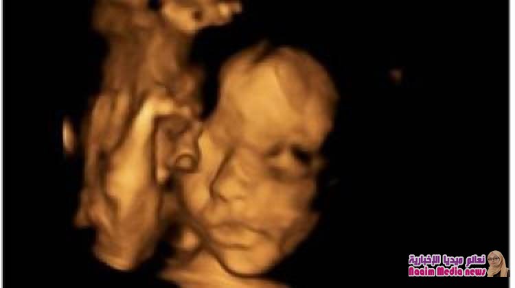 عملية جراحية بالعمود الفقري لجنين في رحم أمه