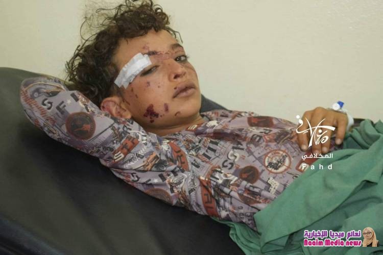 استمرار مليشيا الحوثي  استهداف المدنيين بما في ذلك الأطفال