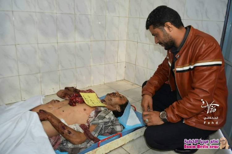 استمرار مليشيا الحوثي  استهداف المدنيين بما في ذلك الأطفال