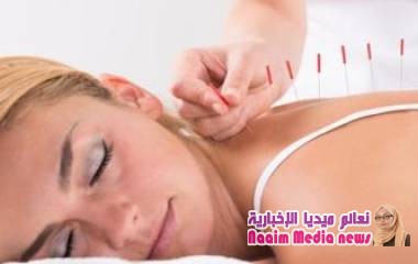 هل تخفف الإبر الصينية من أعراض انقطاع الطمث؟