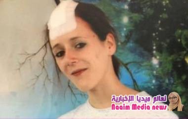 كيف دفع اليأس شابة في بريطانيا إلى ابتلاع فرشاة أسنان؟