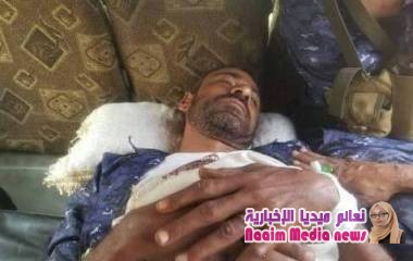 اصابات في الحملة الامنيه بتعز