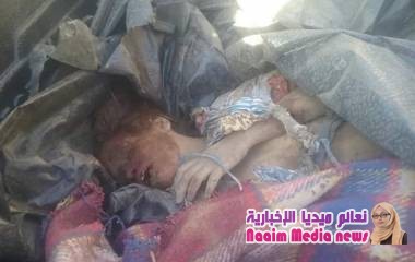 مدير عام مديرية جبل حبشي يدين قصف المليشيات الحوثية للمناطق الآهلة بالسكان بالمديرية ويطالب المجتمع الدولي بمعاقبتها والإنتصار لحال المدنيين.