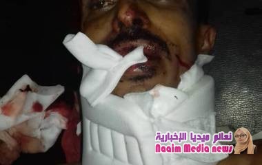 احدى نتائج ممارسة جرائم الحوثي بزرع الالغام