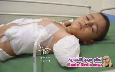 إصابة الطفل محمد رزاز بقذيفة هاون