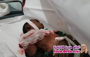 تعز : مجزرة بشعة ترتكبها مليشيا الحوثي الانقلابية بحق تجمع للمدنيين 