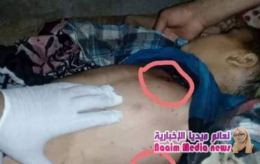 إصابة الطفل شاكر رشدي