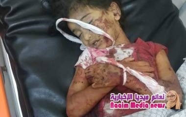 استشهاد طفلتين وإصابة والدتهما في قصف حوثي على منزل شرق صبر