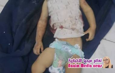 استشهاد طفل وإصابة طفلتين إحداهما بجروح خطرة،