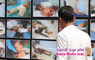 تعز : الحملة الوطنية لاستعادة الدولة ، تقيم معرض صور لتجسيد انتهاكات مليشيا الحوثي