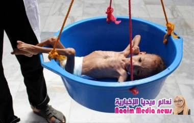 *تقرير بالأرقام | اليمن أكبر فجوة فقر في العالم*