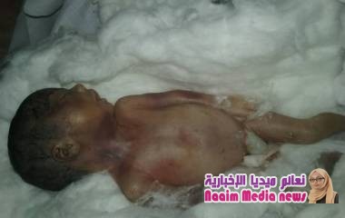 ابشع الجرائم الا انسانيه في تعز