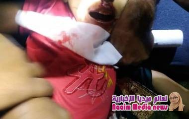 خلال ٢٤ ساعة استشهاد وإصابة 4 أطفال بقصف إرهابي لمليشيات الحوثي بالصلو جنوب تعز