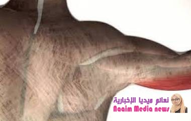 تصلب اللفافة .. التعريف والأعراض والعلاج