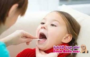 إصابات متكررة ومضاعفات محتملة .. متى ينبغي استئصال اللوزتين؟