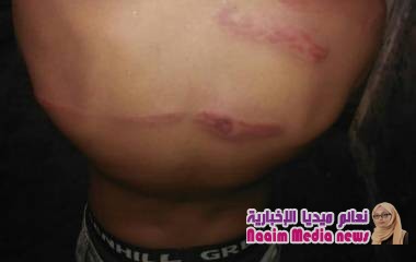 تعز: شيخ قبلي يعتدي بالضرب الجسدي المبرح على طفل في عمر 11 سنه.