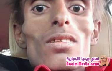 اللاعب شكري محمد علي شكري يتكفل بعلاج رياض القادري