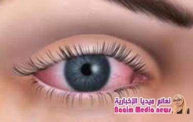 ماهو جفاف العين وكيفية علاجه