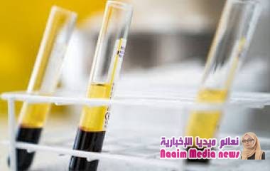 استخدام "بلازما الدم" يبشر بعلاج المصابين بفيروس "كورونا"