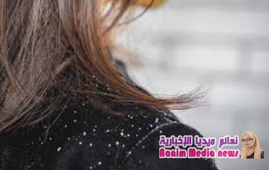 تخجلين من تناسل قشرة رأسك؟ .. الحلول في يدك و"بطنك"