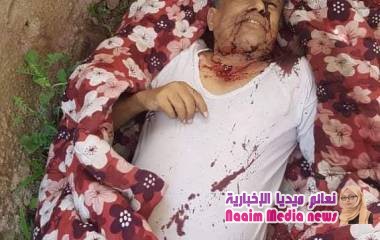 تعز شرعب السلام الزوحه كارثه..