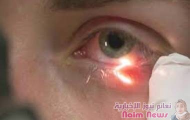تعرض العين للضوء الأحمر العميق يحسن من القدرة البصرية‎