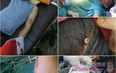 *الرصاص الراجع .. القاتل المجهول .. والموت النازل من السماء*