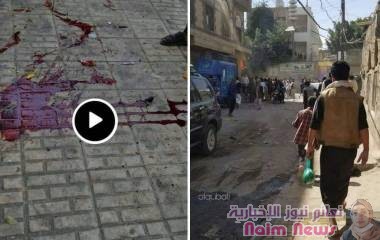 #صنعاء : #متابعات مقتل 3 مواطنين على الأقل بينهم طفلة وإصابة عدد من الجرحى