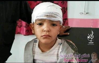 شهيد وثلاثه جرحى جراء استهداف مليشيات الحوثي عدد من الاحياء السكنية