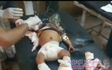 مقتل وإصابة 17 مدنياً في مجزرة مروعة ارتكبتها المليشيا جنوبي الحديدة