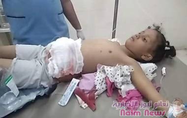 اصابة الطفله نهال عبده