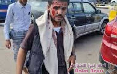 اصابة مسوولين بانفجار عدن