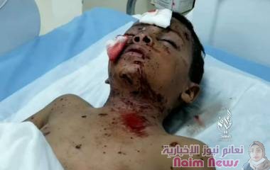 انفجار لغم أرضي للحوثيين "بشيول