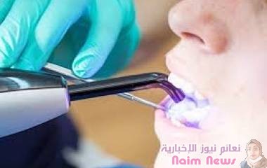 حشوات الأسنان .. المزايا والعيوب