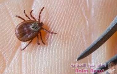 حشرة القُراد تصيبك بهذه الأمراض الخطيرة