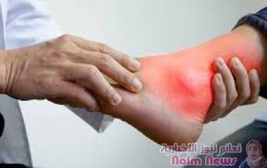أسباب وأعراض النقرس .. تعرف عليها