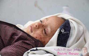 المركز الأمريكي للعدالة يدين استمرار الحوثيين في استهداف الاعيان المدنية في مارب و تعز وسقوط ضحايا مدنيين