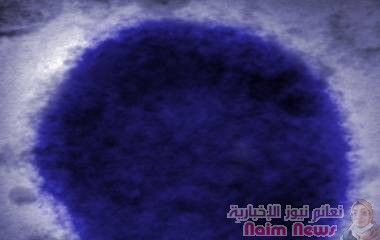 خبراء يحثّون "الجميع" على التأهب لعرضين رئيسيين لجدري القردة!