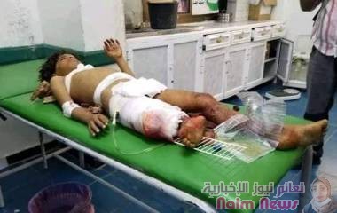 وزارة الصحه ورشة تعريفية حول( مجتمعي بيتي )